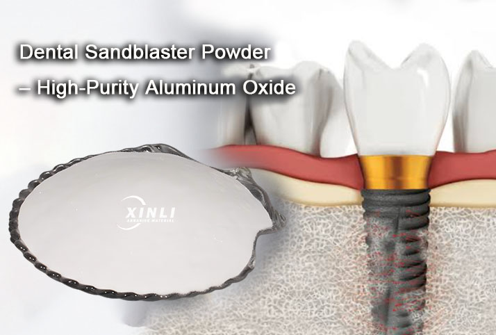 Dental Sandblaster Powder – High-Purity Aluminum Oxide